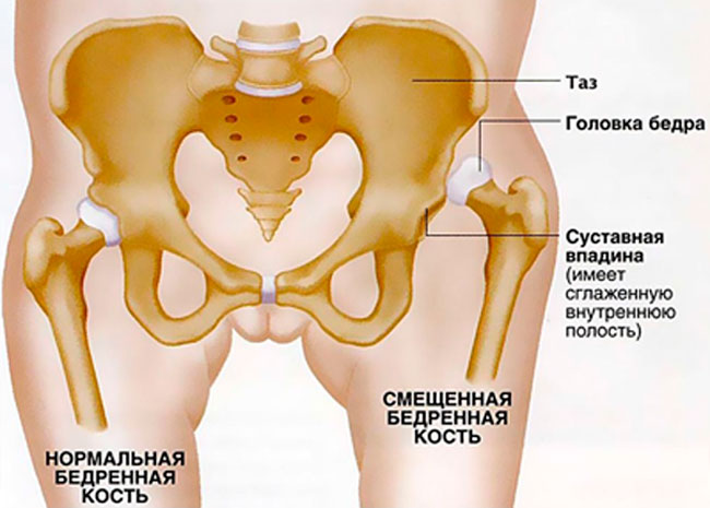 Комплексная диагностика и лечение суставов в Германии