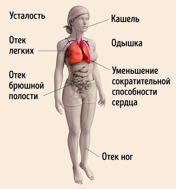 Выявление сердечной недостаточности по анализу крови