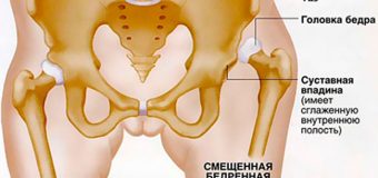 Комплексная диагностика и лечение суставов в Германии